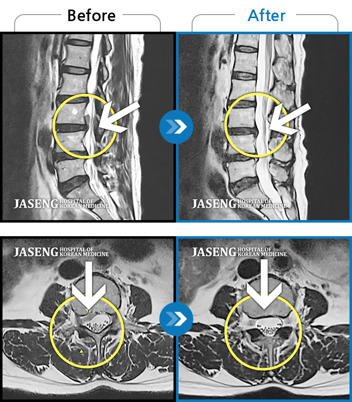 mri.jpg