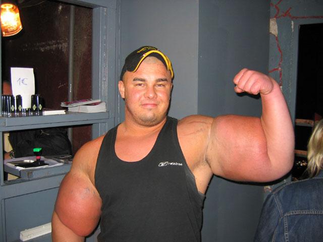 synthol_dickhead.jpg