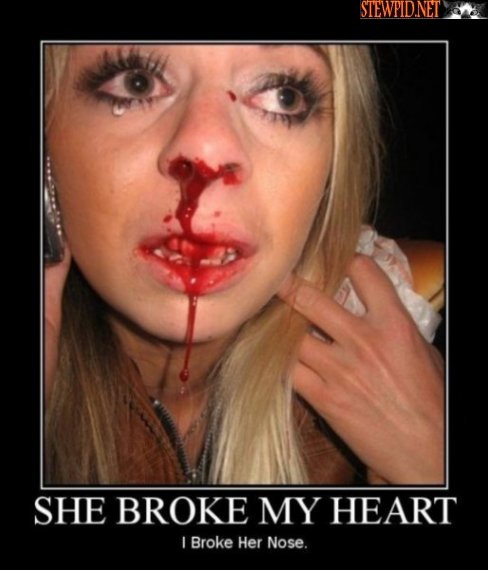broke-her-nose.jpg