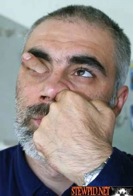 finger-eye.jpg