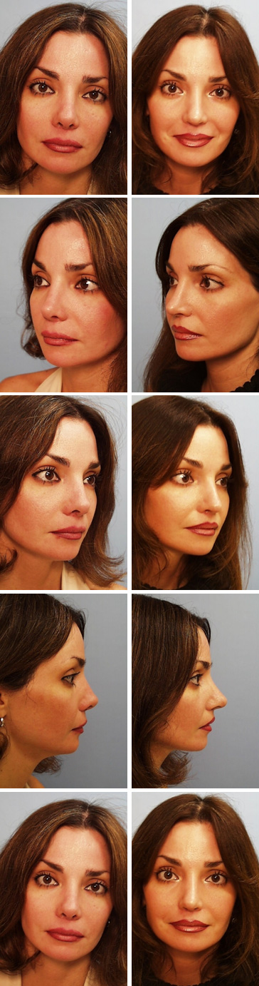 shortnose$08.jpg
