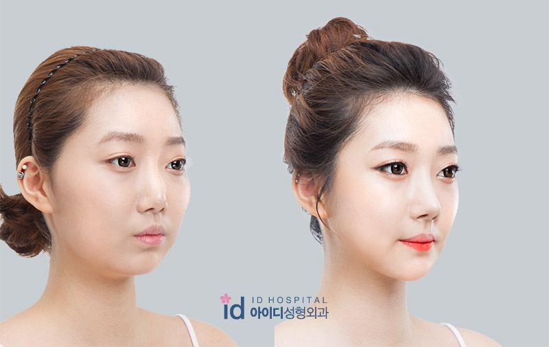 바비코 3.jpg